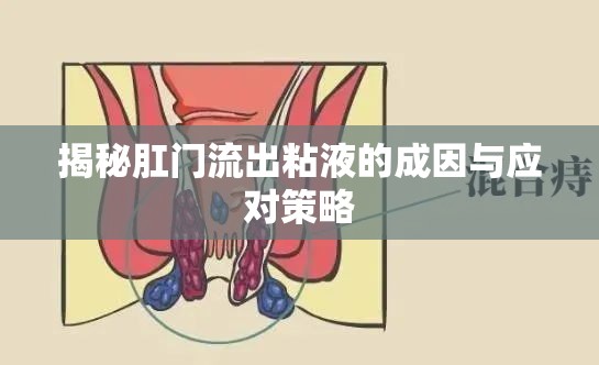 揭秘肛門流出粘液的成因與應對策略