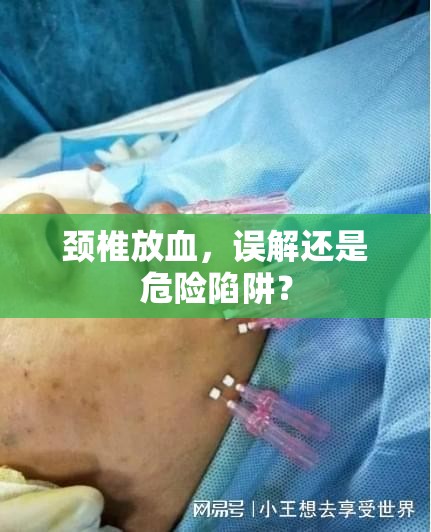 頸椎放血，誤解還是危險陷阱？
