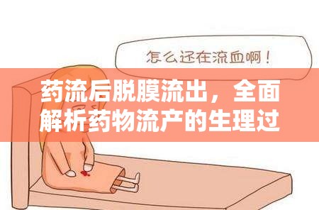 藥流后脫膜流出，全面解析藥物流產(chǎn)的生理過程與注意事項(xiàng)