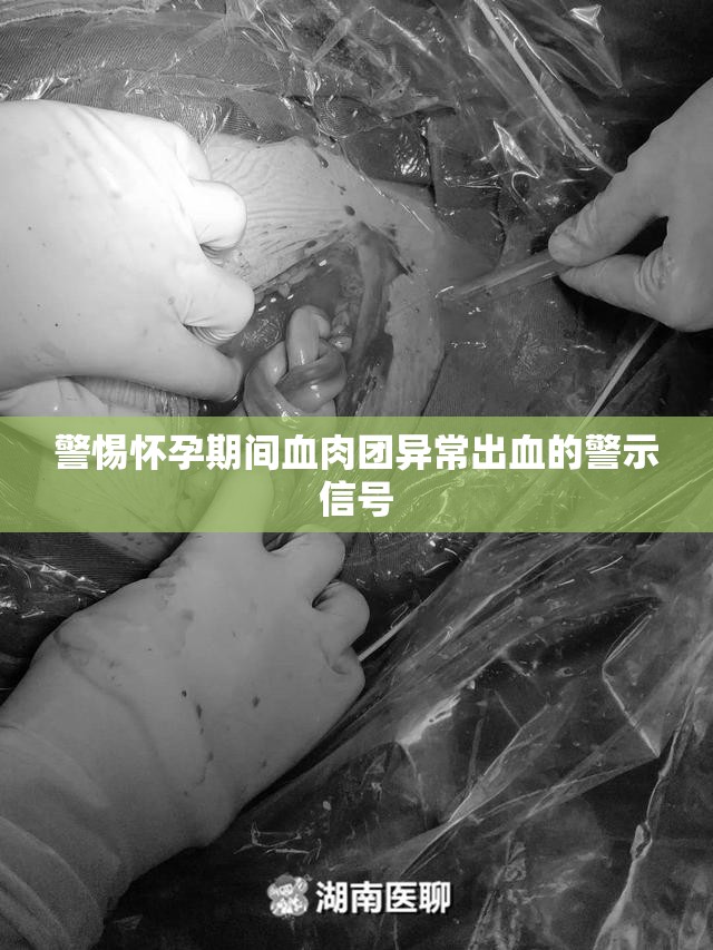 警惕懷孕期間血肉團(tuán)異常出血的警示信號
