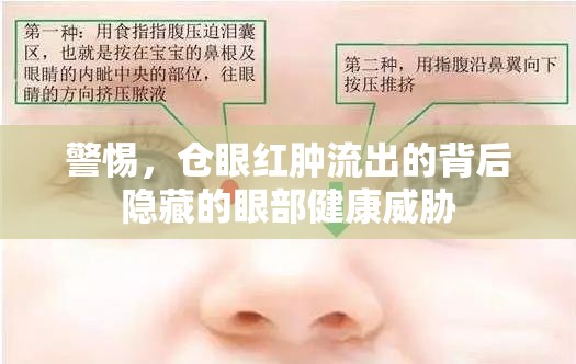 警惕，倉(cāng)眼紅腫流出的背后隱藏的眼部健康威脅