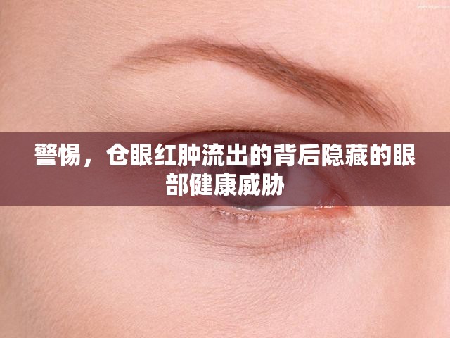警惕，倉(cāng)眼紅腫流出的背后隱藏的眼部健康威脅