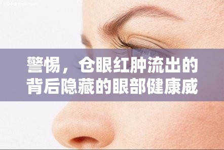 警惕，倉(cāng)眼紅腫流出的背后隱藏的眼部健康威脅