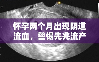 懷孕兩個(gè)月出現(xiàn)陰道流血，警惕先兆流產(chǎn)風(fēng)險(xiǎn)