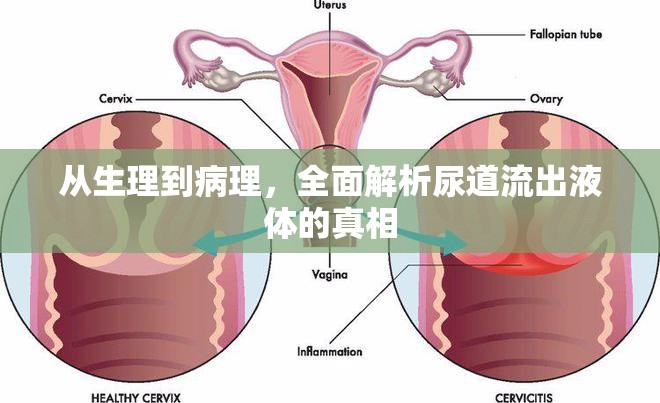 從生理到病理，全面解析尿道流出液體的真相