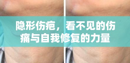 隱形傷疤，看不見的傷痛與自我修復(fù)的力量
