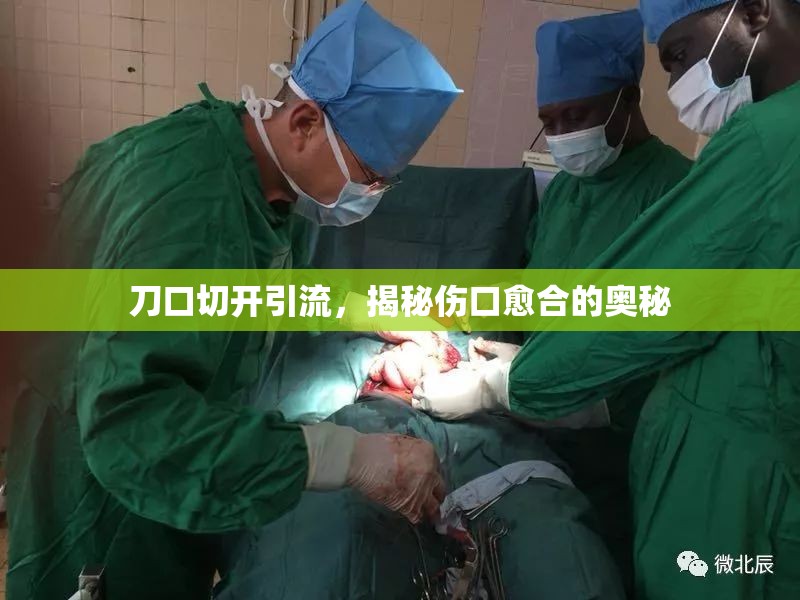刀口切開引流，揭秘傷口愈合的奧秘