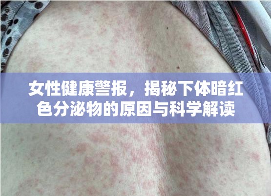 女性健康警報(bào)，揭秘下體暗紅色分泌物的原因與科學(xué)解讀