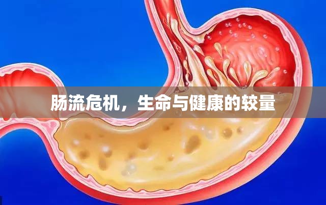 腸流危機(jī)，生命與健康的較量