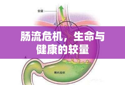 腸流危機(jī)，生命與健康的較量