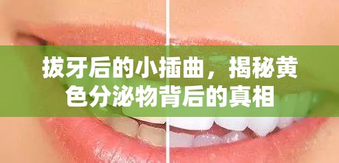 拔牙后的小插曲，揭秘黃色分泌物背后的真相