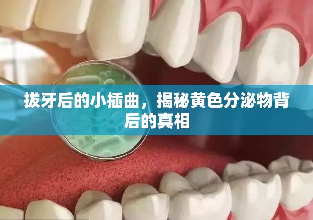 拔牙后的小插曲，揭秘黃色分泌物背后的真相