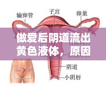做愛后陰道流出黃色液體，原因解析與應(yīng)對(duì)措施