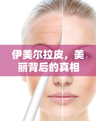 伊美爾拉皮，美麗背后的真相與風(fēng)險(xiǎn)揭秘