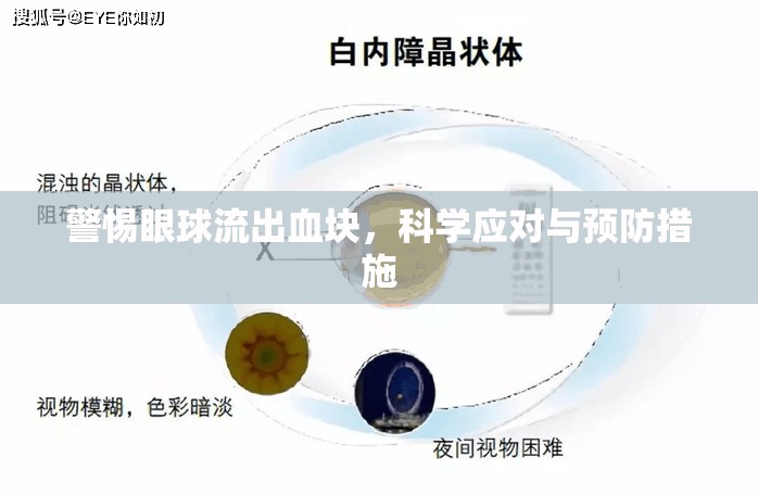 警惕眼球流出血塊，科學應對與預防措施
