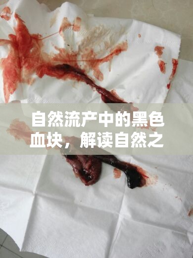 自然流產(chǎn)中的黑色血塊，解讀自然之痛