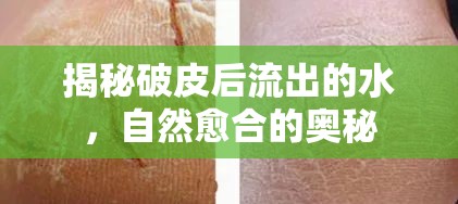揭秘破皮后流出的水，自然愈合的奧秘