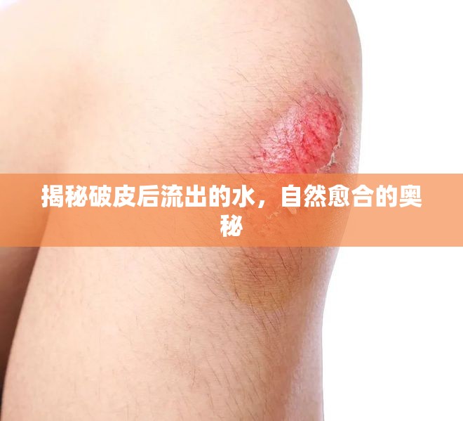 揭秘破皮后流出的水，自然愈合的奧秘