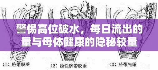 警惕高位破水，每日流出的量與母體健康的隱秘較量