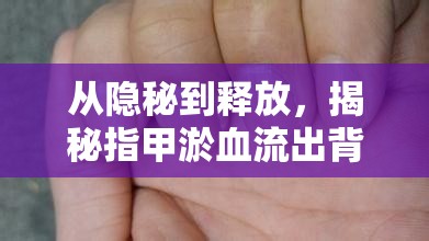 從隱秘到釋放，揭秘指甲淤血流出背后的健康小知識