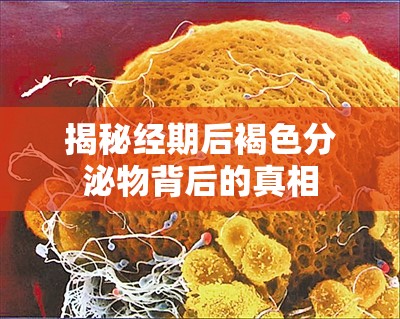 揭秘經(jīng)期后褐色分泌物背后的真相