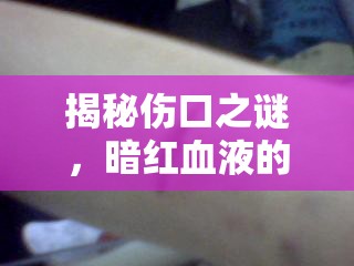 揭秘傷口之謎，暗紅血液的緩緩流淌