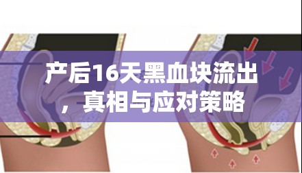 產(chǎn)后16天黑血塊流出，真相與應(yīng)對(duì)策略