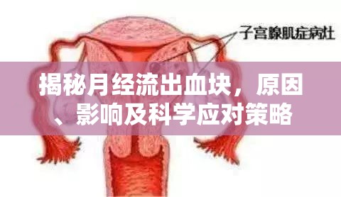 揭秘月經(jīng)流出血塊，原因、影響及科學(xué)應(yīng)對(duì)策略