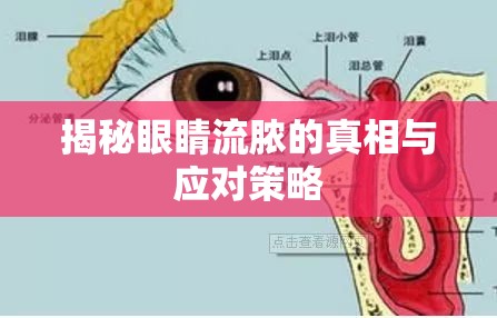 揭秘眼睛流膿的真相與應(yīng)對(duì)策略