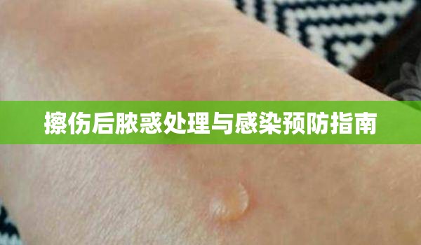 擦傷后膿惑處理與感染預(yù)防指南