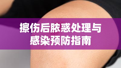 擦傷后膿惑處理與感染預(yù)防指南
