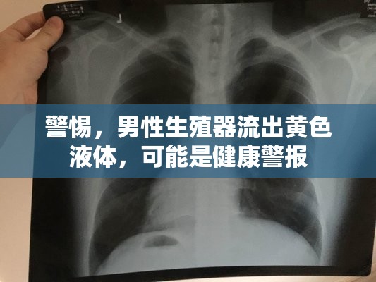 警惕，男性生殖器流出黃色液體，可能是健康警報(bào)