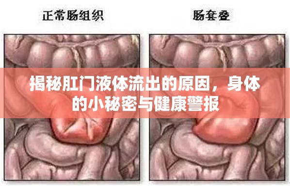 揭秘肛門液體流出的原因，身體的小秘密與健康警報(bào)