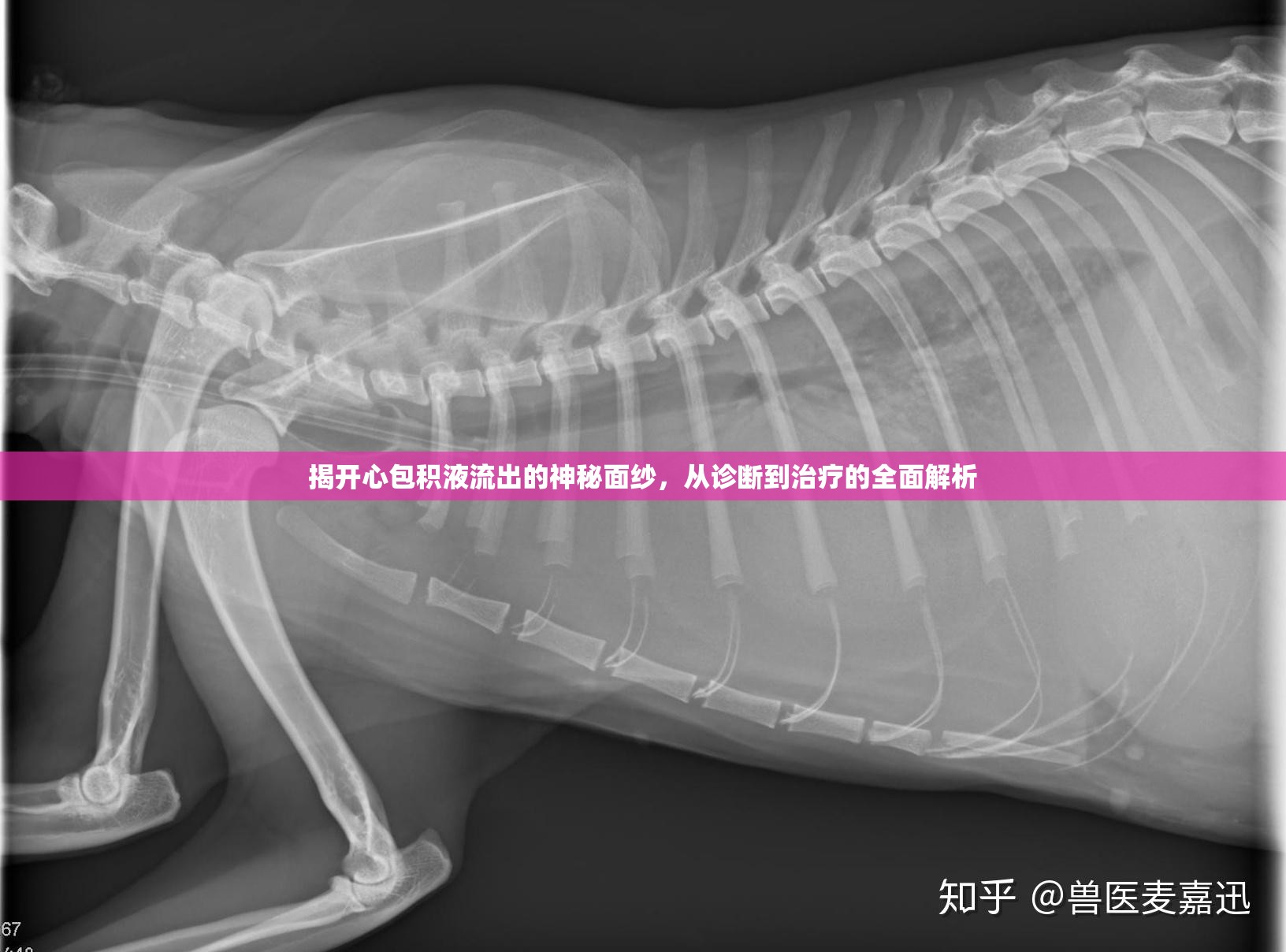 揭開心包積液流出的神秘面紗，從診斷到治療的全面解析