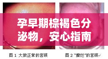 孕早期棕褐色分泌物，安心指南與科學(xué)解析