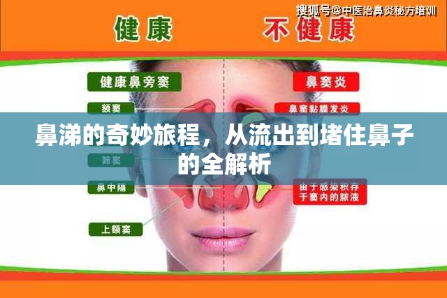 鼻涕的奇妙旅程，從流出到堵住鼻子的全解析
