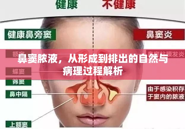 鼻竇膿液，從形成到排出的自然與病理過程解析