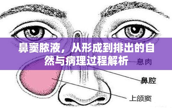 鼻竇膿液，從形成到排出的自然與病理過程解析