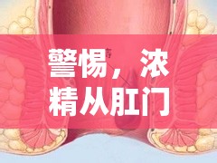 警惕，濃精從肛門流出，可能是健康問題的信號