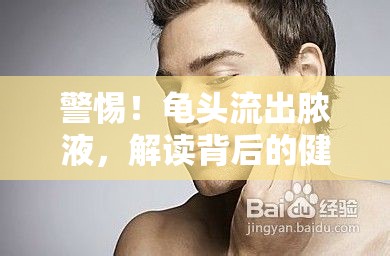 警惕！龜頭流出膿液，解讀背后的健康警報(bào)