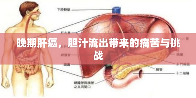 晚期肝癌，膽汁流出帶來的痛苦與挑戰(zhàn)