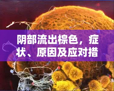陰部流出棕色，癥狀、原因及應(yīng)對(duì)措施