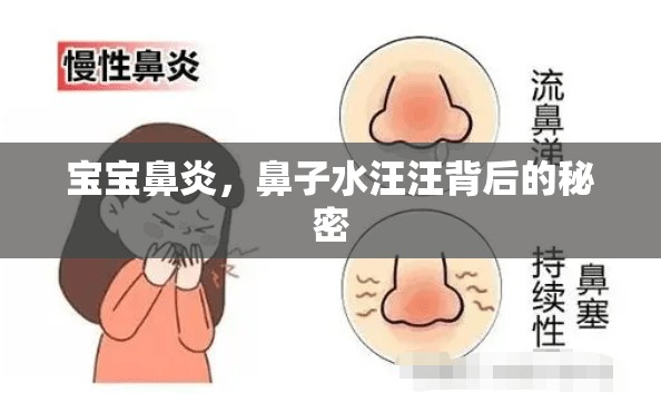 寶寶鼻炎，鼻子水汪汪背后的秘密