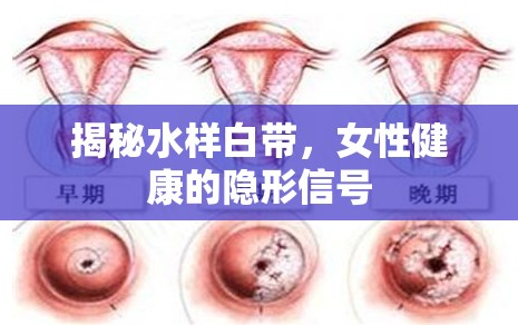 揭秘水樣白帶，女性健康的隱形信號