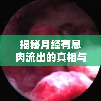 揭秘月經(jīng)有息肉流出的真相與應(yīng)對策略