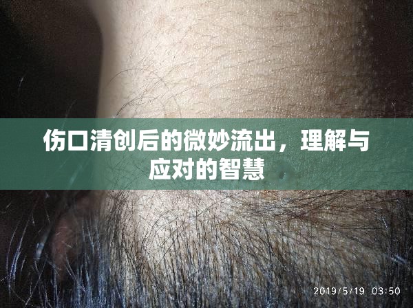 傷口清創(chuàng)后的微妙流出，理解與應(yīng)對的智慧