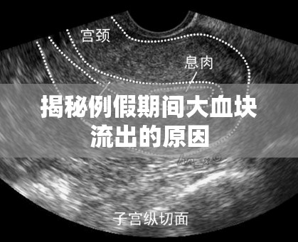 揭秘例假期間大血塊流出的原因