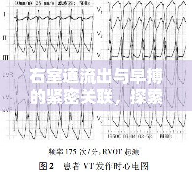 右室道流出與早搏的緊密關(guān)聯(lián)，探索心臟奧秘