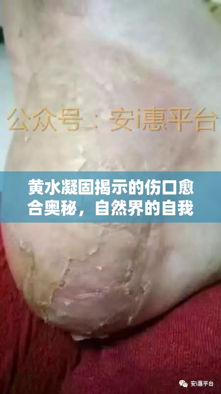 黃水凝固揭示的傷口愈合奧秘，自然界的自我修復(fù)之旅