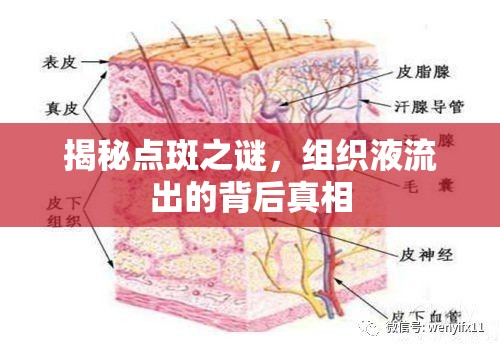 揭秘點斑之謎，組織液流出的背后真相